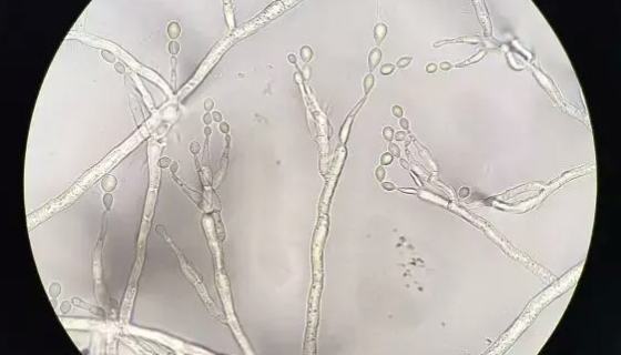 樹脂枝孢霉的形態(tài)特征與分布范圍及保藏方法！