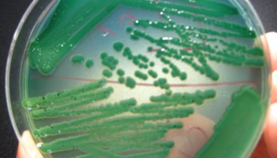 嗜鹽菌的適應機理與排鹽作用及診斷治療！