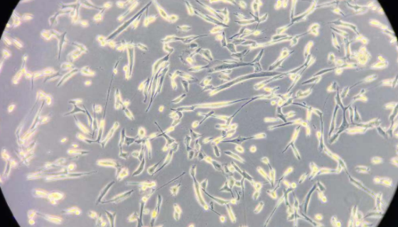 人肺腺癌細胞的主要應用與培養(yǎng)操作及相關研究！