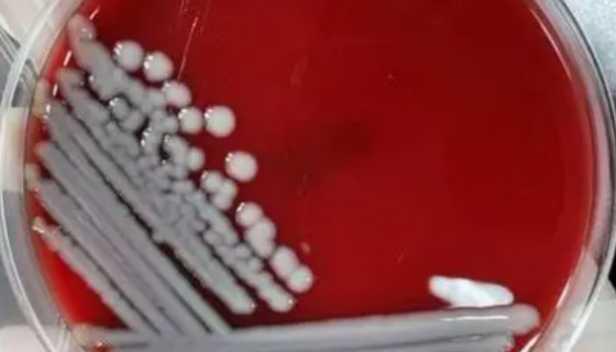 麥角菌的分布區(qū)域與傳播方式及形態(tài)特征與藥用價值！