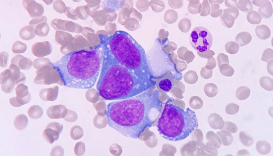 KG-1A人急性骨髓白血病細(xì)胞系的培養(yǎng)步驟及應(yīng)用！