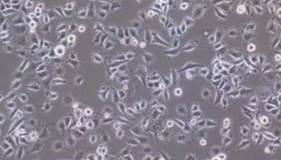 人膀胱移行細(xì)胞癌細(xì)胞的培養(yǎng)步驟及應(yīng)用與研究！