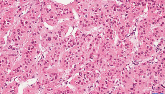 人腎上腺皮質(zhì)細(xì)胞的背景與應(yīng)用及相關(guān)研究！