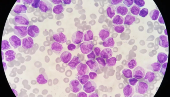 急性早幼粒細(xì)胞株的培養(yǎng)步驟與應(yīng)用及研究動(dòng)態(tài)！