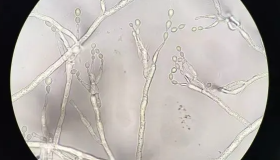 澳大利亞平臍蠕孢的形態(tài)特征與產(chǎn)品優(yōu)勢(shì)及用途！