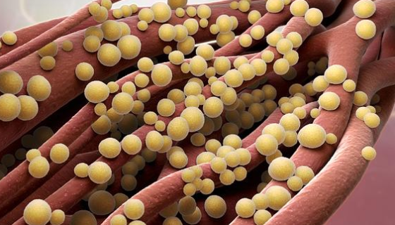 茶藨子葡萄座腔菌的傳播發(fā)病與危害及防治方法！