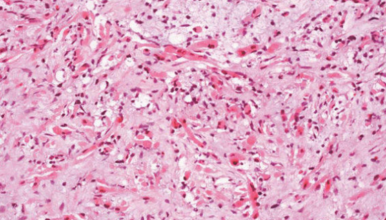 人惡性胚胎橫紋肌瘤細(xì)胞的培養(yǎng)操作及注意事項(xiàng)！