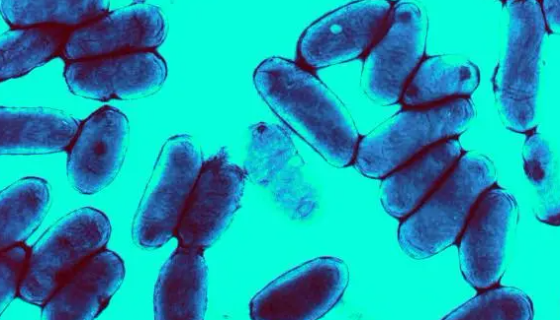 支氣管炎鮑特氏菌的培養(yǎng)條件與注意事項(xiàng)有哪些？