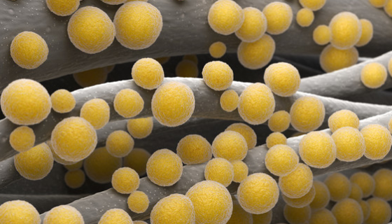 金黃色葡萄球菌在食品中的來源及流行性病學(xué)研究！