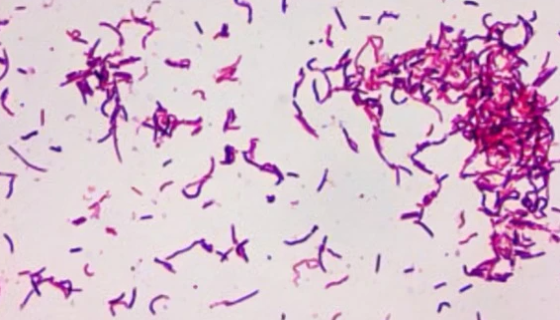 紅斑丹毒絲菌的病原特征與流行情況及防治措施！