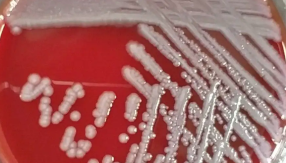 用于分析檢測(cè)與質(zhì)量控制的：酸土脂環(huán)酸芽孢桿菌