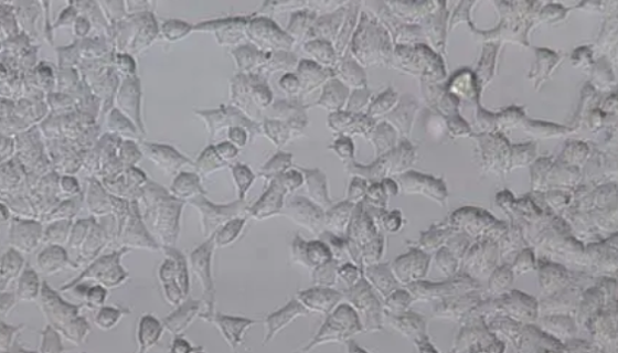 胎牛血清(無支原體)的營(yíng)養(yǎng)功能及應(yīng)用研究！