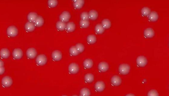 糞產(chǎn)堿菌糞亞種——API和汽車產(chǎn)品質(zhì)控用菌