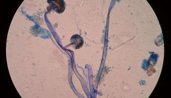 根霉的形態(tài)特征與主要用途及發(fā)生條件與防治方法！