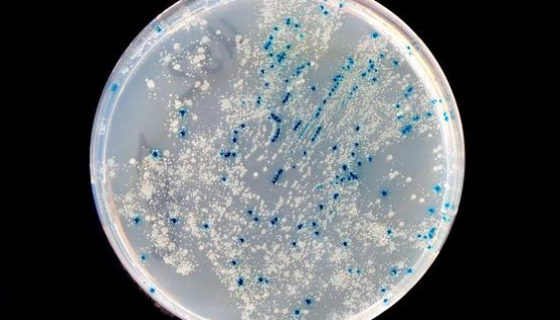 申克氏孢子丝菌的培养特点与染色反应及诊断与治疗！