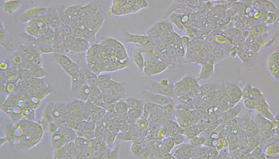 絨猴EBV轉(zhuǎn)化的白細(xì)胞的應(yīng)用及培養(yǎng)操作規(guī)程！