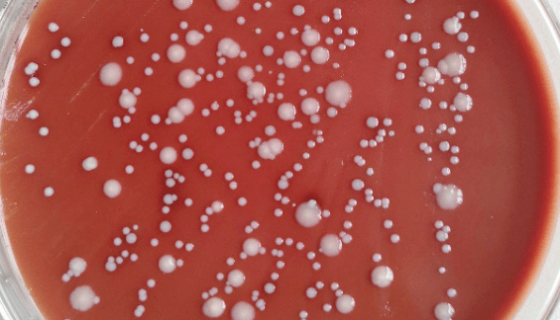 耐久腸球菌PCR試劑盒的知識與工作原理及應(yīng)用！