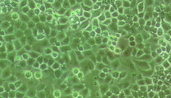 HOP-92人小細胞肺癌貼壁細胞系的應用！