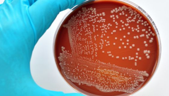 微生物检测培养基的分装与灭菌方法及质量检查！