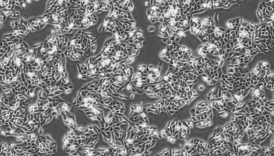 MCF-7B人乳腺癌細胞系的培養(yǎng)特點及應用！