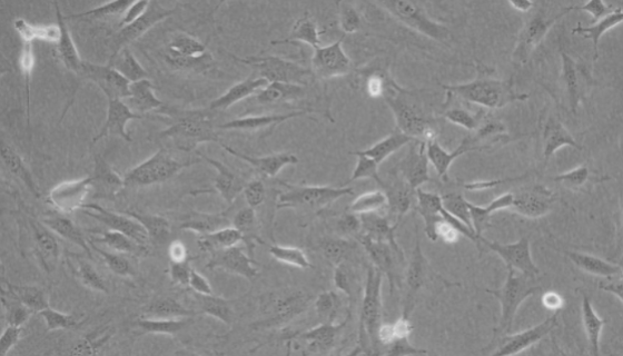 小鼠胚胎成纖維細胞(MEF)完全培養(yǎng)基的應用！