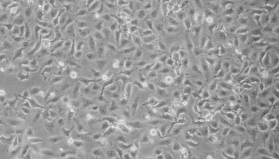 5637人膀胱癌細胞的應用與培養(yǎng)操作及研究動態(tài)！