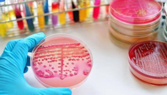 微生物培养基的类型——实验达人们看过来！