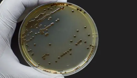 微生物检测菌落繁殖连成一片的原因分析！