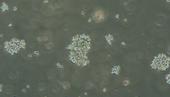 NK-92MI人惡性非霍奇金淋巴瘤患者NK細(xì)胞系的應(yīng)用！