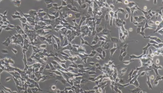 人神經(jīng)母細(xì)胞瘤細(xì)胞的培養(yǎng)操作步驟及應(yīng)用研究！