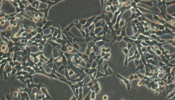 A101D 人黑色素瘤貼壁細(xì)胞系的特點(diǎn)與應(yīng)用！