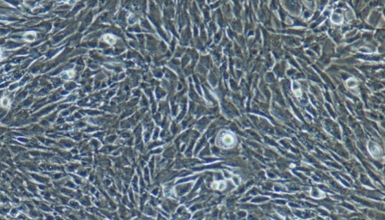 小鼠視網(wǎng)膜神經(jīng)節(jié)細(xì)胞株的培養(yǎng)操作及應(yīng)用！