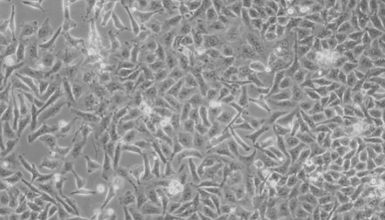 人胃腺癌細(xì)胞(低分化)的應(yīng)用及培養(yǎng)操作步驟！