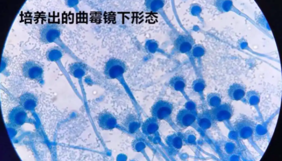 小菌核曲霉的形態(tài)特征與生長環(huán)境及主要價值！