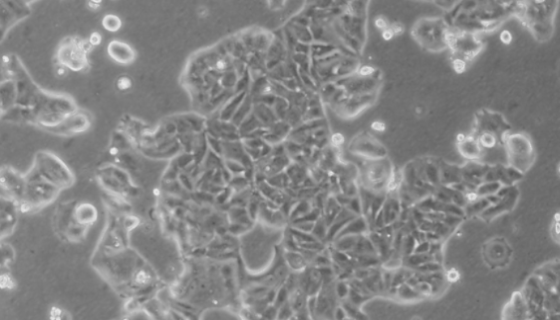 MDA-KB2人正常乳腺貼壁細(xì)胞系的特點(diǎn)與應(yīng)用！
