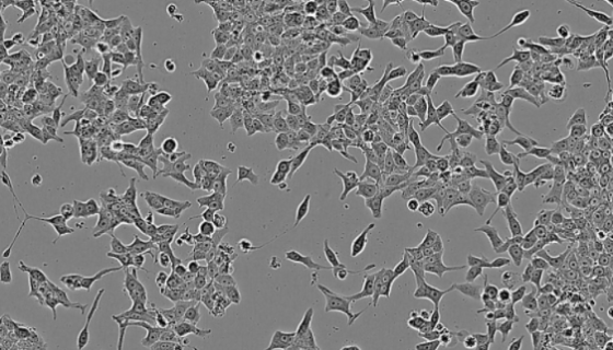 NCI-H526人肺癌貼壁細(xì)胞系的培養(yǎng)操作及應(yīng)用！