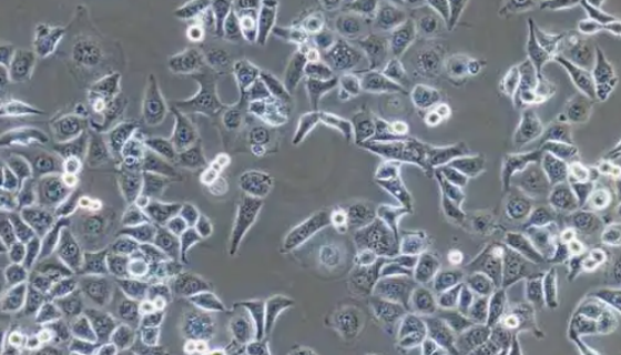 NCI-H647人非小細(xì)胞肺癌貼壁細(xì)胞的應(yīng)用與培養(yǎng)！