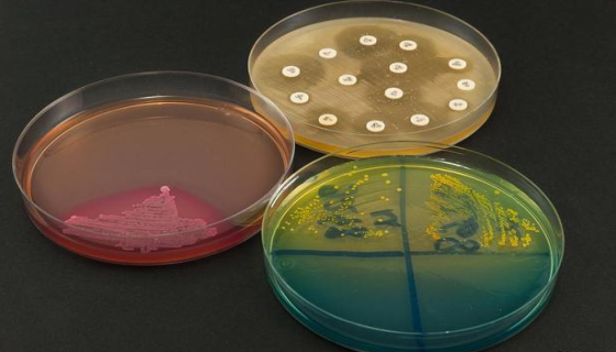 黃桿菌屬的生物學(xué)特性與健康防治及處理措施！