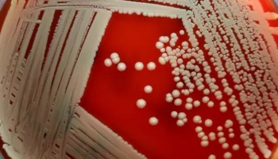 假單胞菌產(chǎn)熒光色素培養(yǎng)基的制法與用途及注意事項(xiàng)！