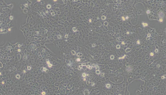 CAL-33人舌磷癌貼壁細(xì)胞系的培養(yǎng)操作及應(yīng)用！