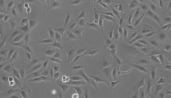HPDE6-C7人正常胰腺導(dǎo)管上皮細(xì)胞的知識(shí)與應(yīng)用！