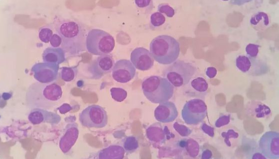 SP2/MIL-6小鼠骨髓瘤B淋巴懸浮細(xì)胞系的應(yīng)用！