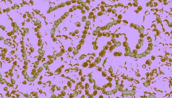 ATCC 51726 少酸鏈球菌的微生物菌種培養(yǎng)方法！