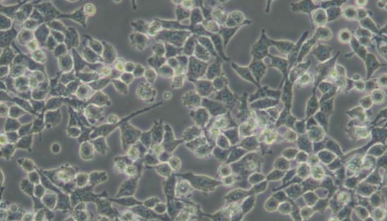 大鼠卵巢顆粒細(xì)胞的處理與使用方法及注意事項(xiàng)！