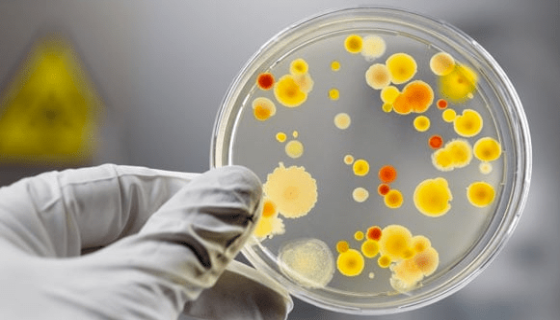 食品生产用水菌落总数超标的原因及预防措施！