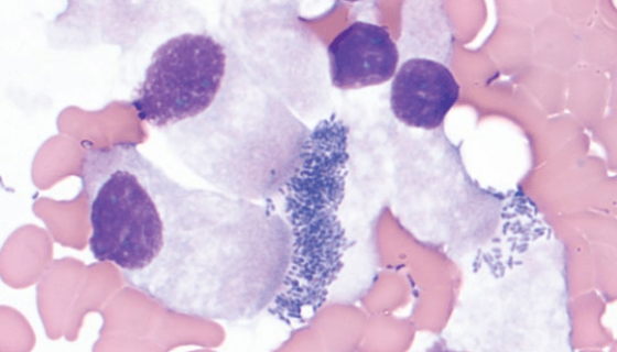 雞敗血支原體PCR試劑盒的培養(yǎng)操作步驟及應(yīng)用！