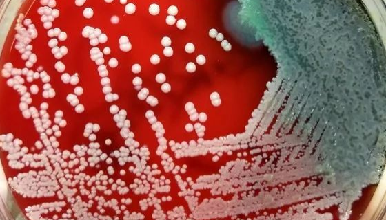 緩慢葡萄球菌——用于分析檢測(cè)和防霉抗菌