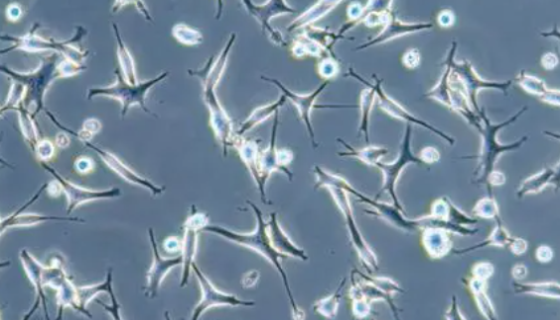 KHOS-240S人骨肉瘤細(xì)胞培養(yǎng)操作及注意事項(xiàng)！