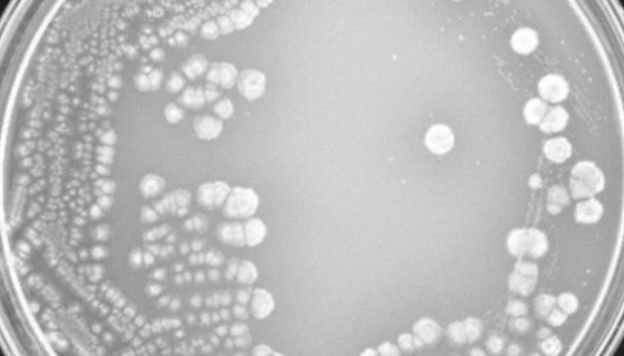 殺結(jié)節(jié)鏈霉菌——產(chǎn)生殺結(jié)核菌素和核酸內(nèi)切酶