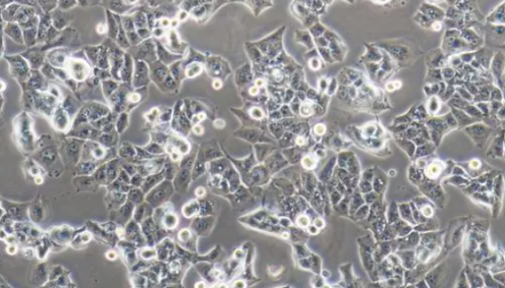 SNU-182人肝癌貼壁細(xì)胞系的應(yīng)用及相關(guān)研究！